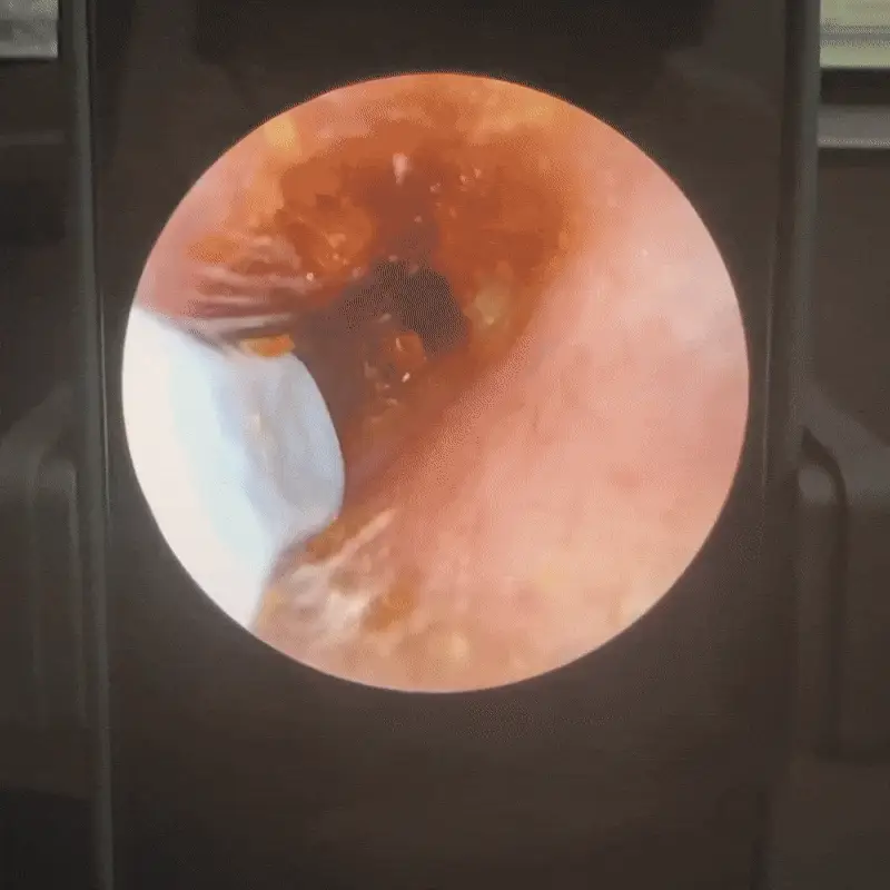 Limpiador inteligente Otiva